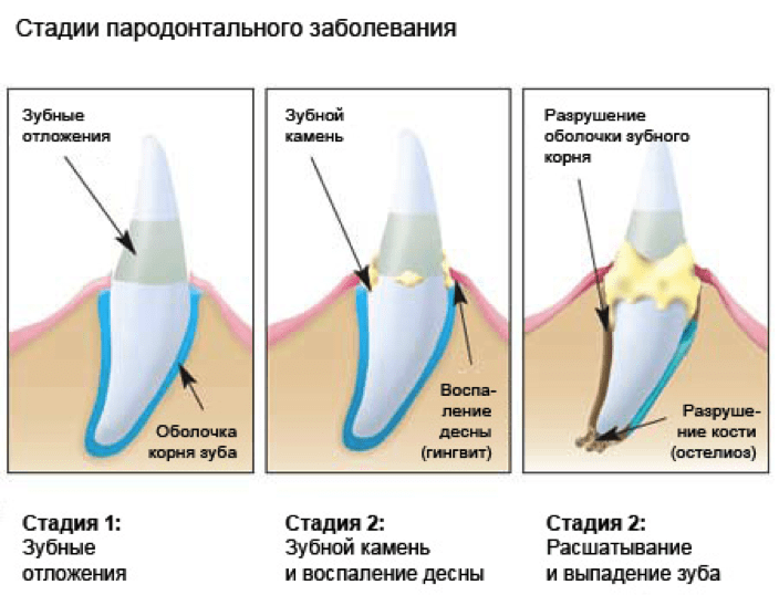 Nwn как забрать камень у замиры